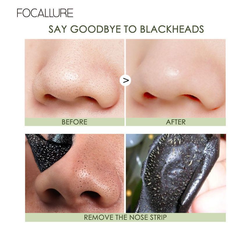 Black Head Remover Pore Strips